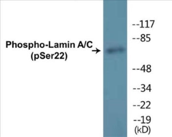 Western blot analysis of extracts from HeLa cells treated with paclitaxel 1uM 24h, using Lamin A (Phospho-Ser22) Antibody.