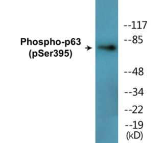Western blot analysis of extracts from LOVO cells treated with nocodazole 1ug/ml 18h, A549 cells treated with nocodazole 1ug/ml 18h and HepG2 cells treated with nocodazole 1ug/ml 18h, using p63 (Phospho-Ser395) Antibody.