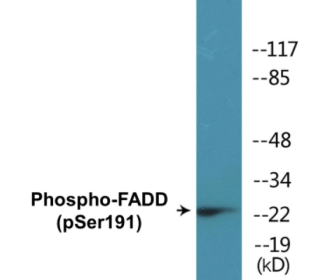Western blot analysis of extracts from Jurkat cells treated with PMA 125ng/ml 30', using FADD (Phospho-Ser191) Antibody.