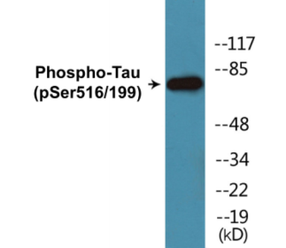 Western blot analysis of extracts from mouse brain, using MAPT (Phospho-Ser516) Antibody.