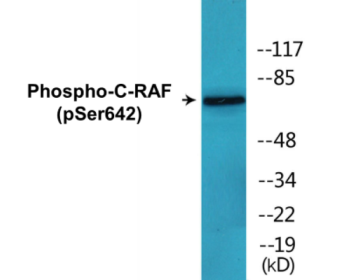 Western blot analysis of extracts from K562 and HuvEc cells treated with PMA, using C-RAF (Phospho-Ser642) Antibody.