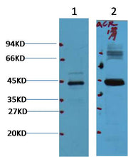 AMACR/P504S  Mouse mAb