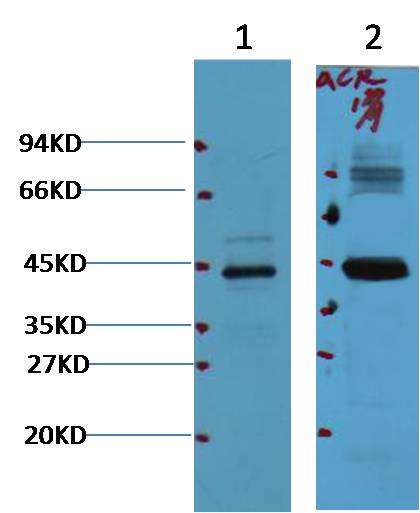 AMACR/P504S  Mouse mAb