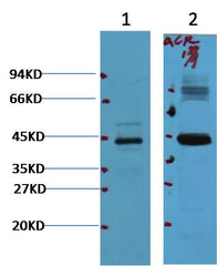 AMACR/P504S  Mouse mAb