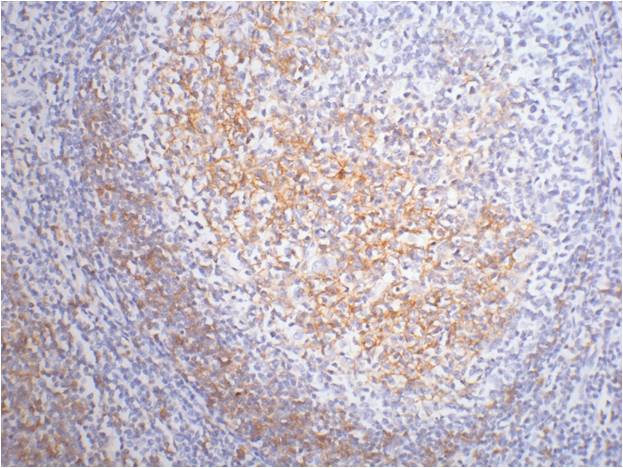 CD23 Mouse mAb