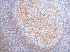 CD23 Mouse mAb