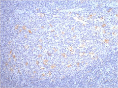 CD68 Mouse mAb