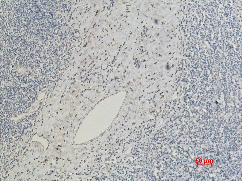 CD5 Mouse mAb