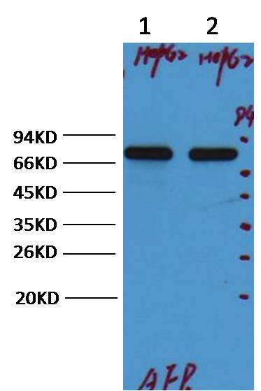 AFP/alpha 1 Fetoprotein Mouse mAb