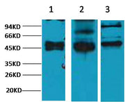 CK17 Mouse mAb