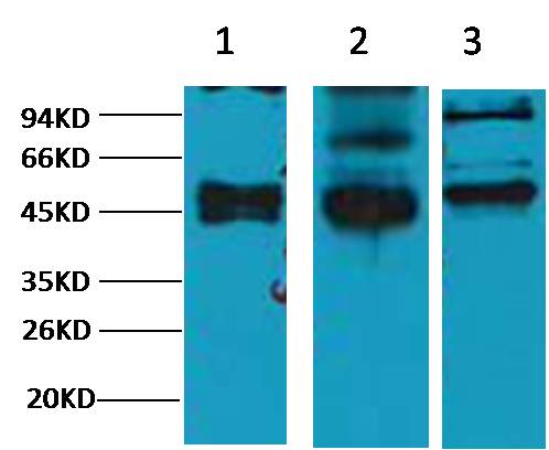 CK17 Mouse mAb