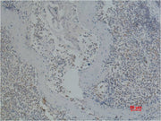 CD41/Integrin α/2b Mouse mAb