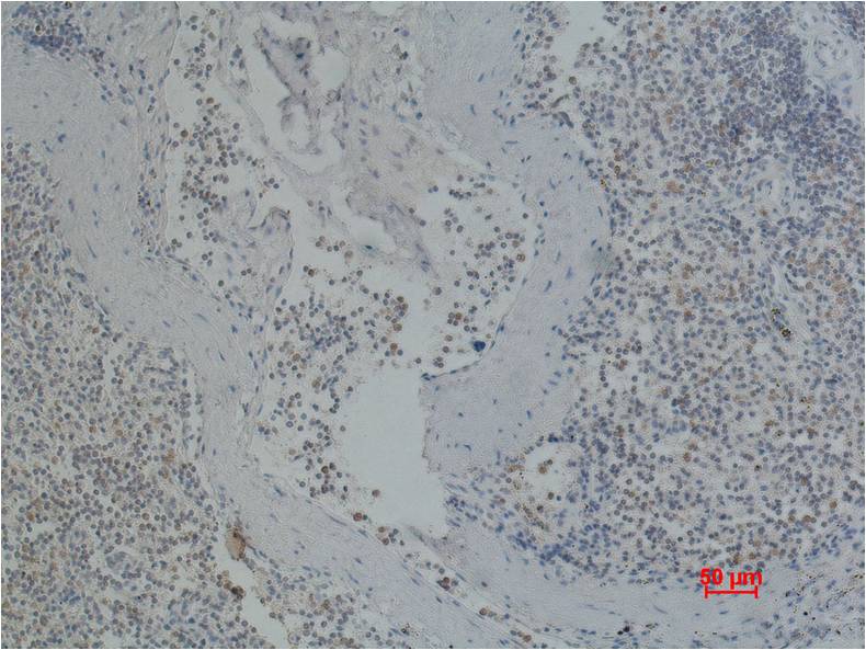 CD41/Integrin α/2b Mouse mAb