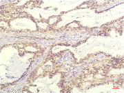 IL-8 (13F8) Mouse mAb