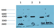 Muscle actin (3E9) Mouse mAb