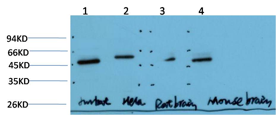Gamma Tubulin (6C12) Mouse mAb