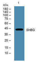 SHBG rabbit pAb