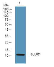 SLUR1 rabbit pAb