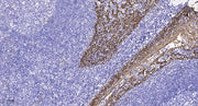 GPR98 rabbit pAb