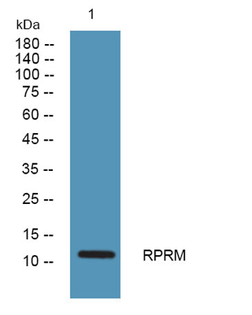 RPRM rabbit pAb