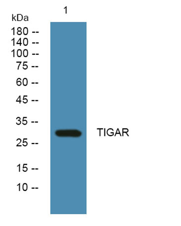 TIGAR rabbit pAb