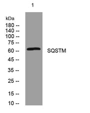 SQSTM1/p62 rabbit pAb