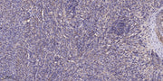 WDR87 rabbit pAb