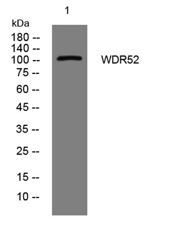 WDR52 rabbit pAb