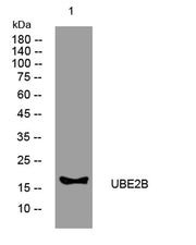 UBE2B rabbit pAb