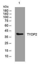 TYDP2 rabbit pAb