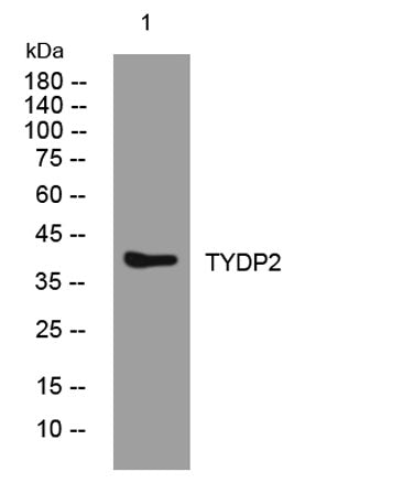 TYDP2 rabbit pAb