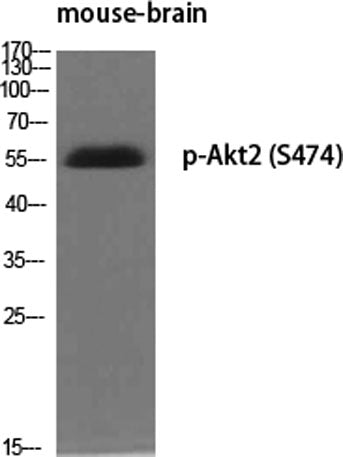 Akt2 (phospho Ser474) rabbit pAb