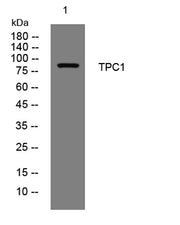 TPC1 rabbit pAb