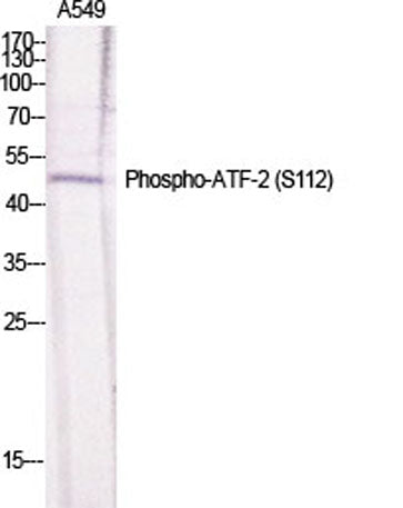ATF-2 (phospho Ser112) rabbit pAb