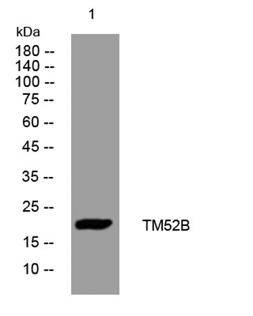 TM52B rabbit pAb