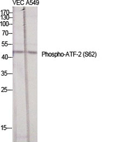 ATF-2 (phospho Ser62) rabbit pAb