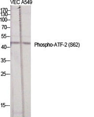 ATF-2 (phospho Ser62) rabbit pAb