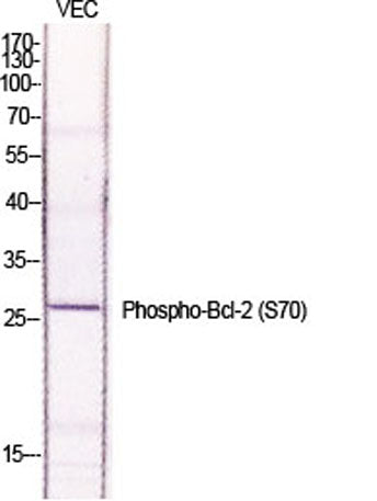 Bcl-2 (phospho Ser70) rabbit pAb