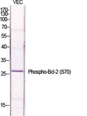 Bcl-2 (phospho Ser70) rabbit pAb