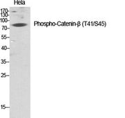 Catenin-β (phospho Thr41/S45) rabbit pAb