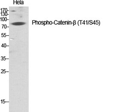 Catenin-β (phospho Thr41/S45) rabbit pAb
