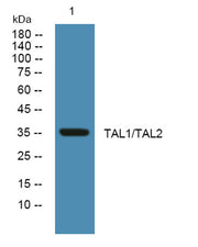 TAL1/TAL2  rabbit pAb