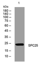 SPC25 rabbit pAb
