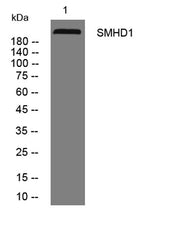 SMHD1 rabbit pAb