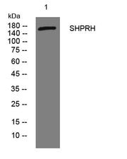 SHPRH rabbit pAb