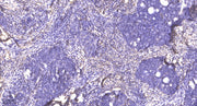 RanBP3 (phospho-Ser58) rabbit pAb