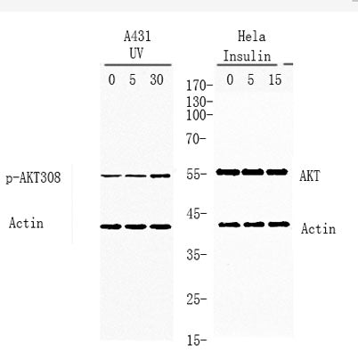 Akt (phospho Thr308) rabbit pAb