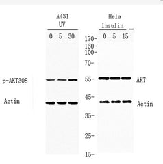 Akt (phospho Thr308) rabbit pAb