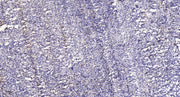 LATS1 (phospho-Thr1079)  rabbit pAb