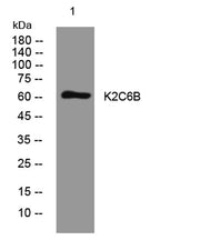 K2C6B rabbit pAb